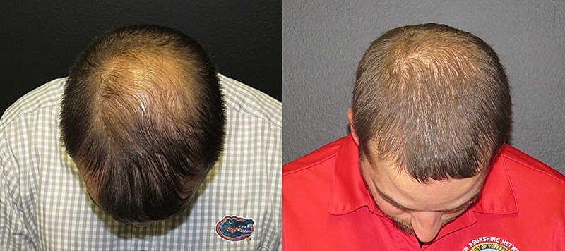 Hair Before & After