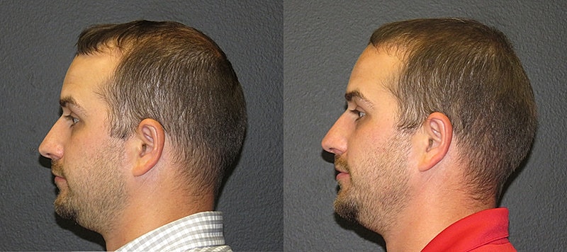 Hair Before & After