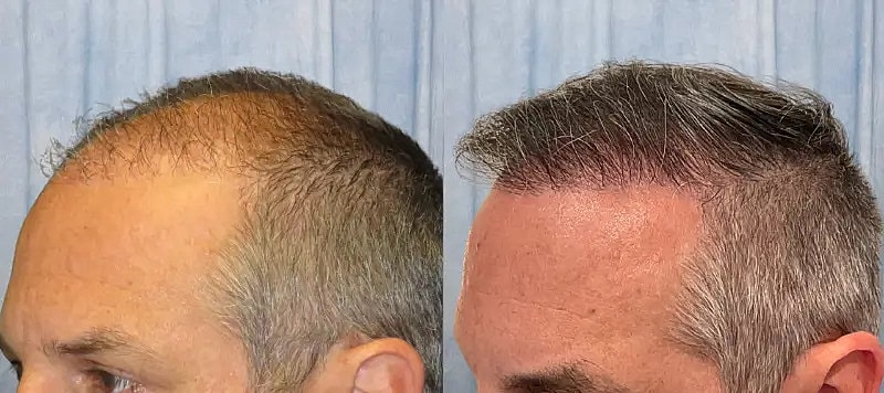 Hair Before & After