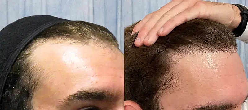 Hair Before & After