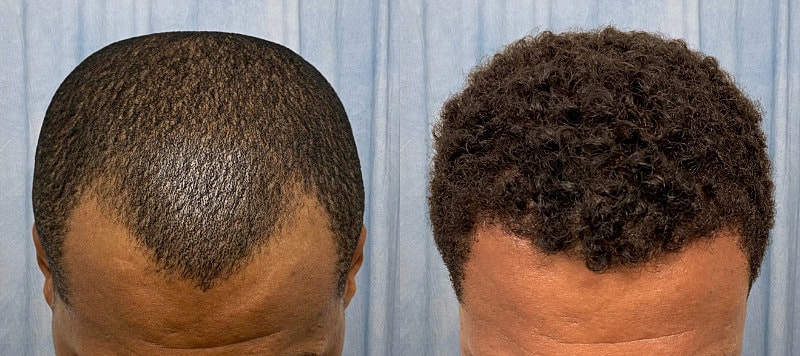 Hair Before & After