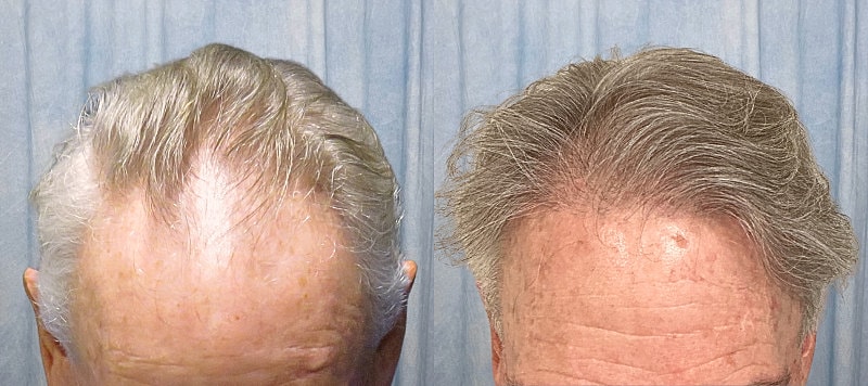 Hair Before & After