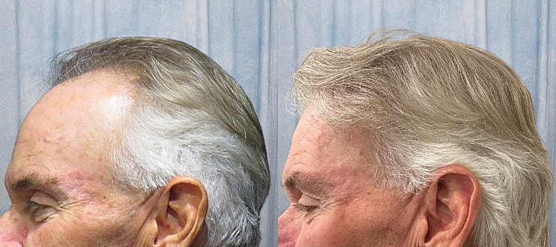 Hair Before & After