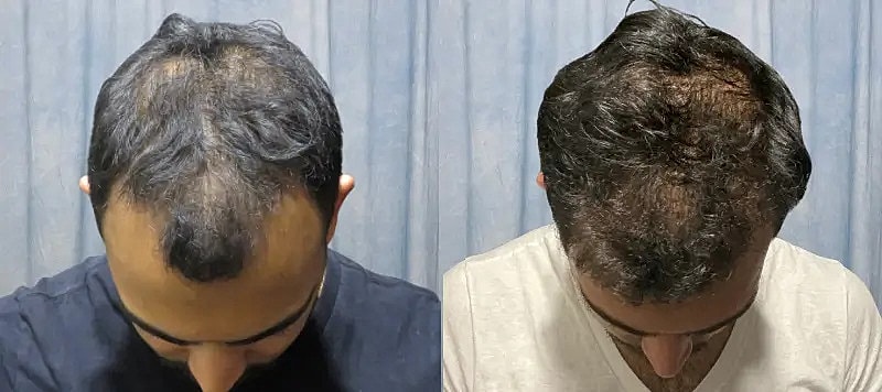 Hair Before & After