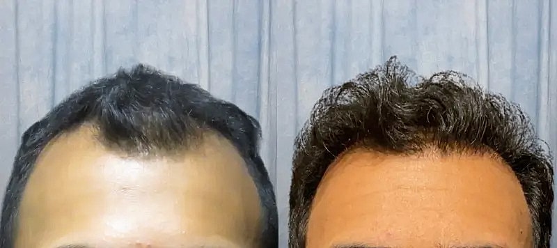 Hair Before & After