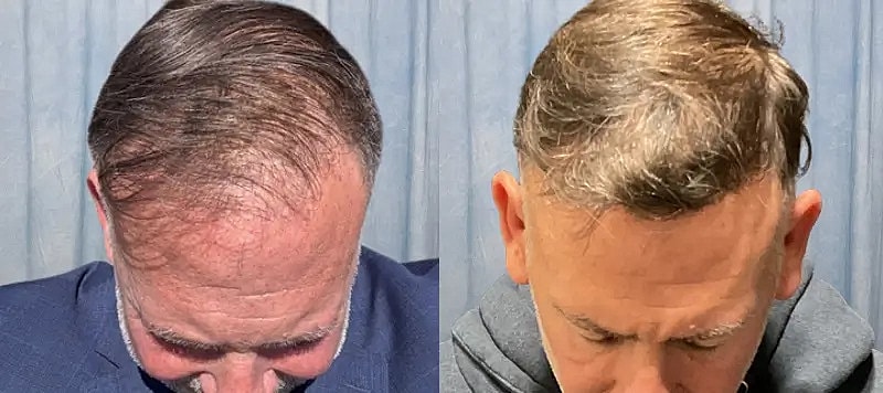 Hair Before & After