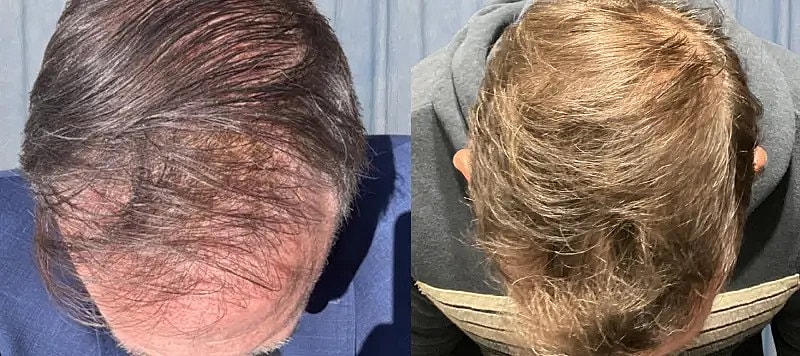 Hair Before & After