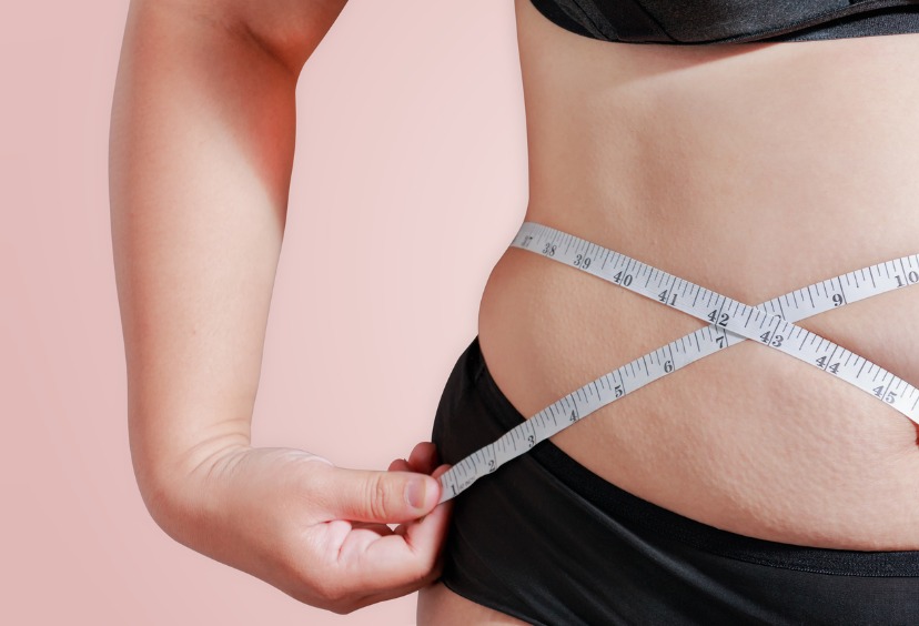 post weight loss surgery