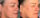 skin care before and after