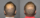 Before and After